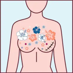 Cancer des seins